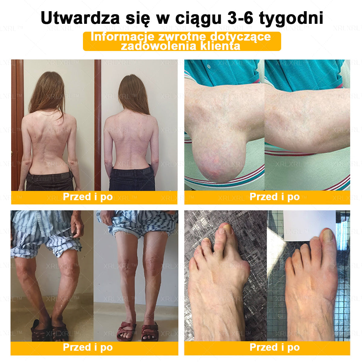 XRLXRL® Jad pszczeli Maść przeciwbólową wspomagającą gojenie kości ✨🌸(Szczególnie dla osób starszych i zalecane przez EFORT)