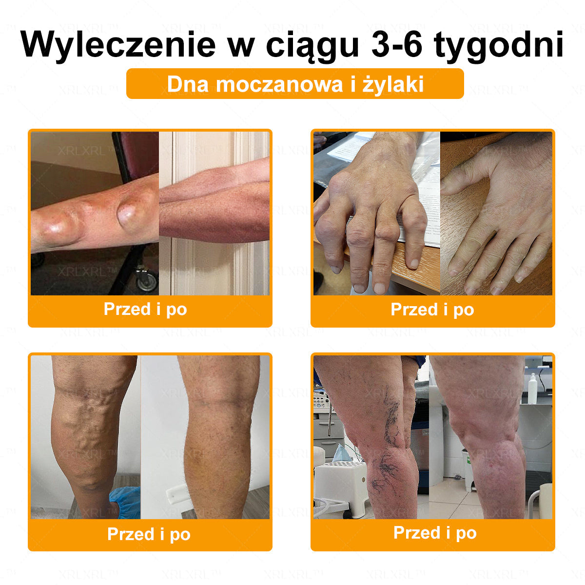 XRLXRL® Jad pszczeli Maść przeciwbólową wspomagającą gojenie kości ✨🌸(Szczególnie dla osób starszych i zalecane przez EFORT)