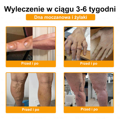 XRLXRL® Jad pszczeli Maść przeciwbólową wspomagającą gojenie kości ✨🌸(Szczególnie dla osób starszych i zalecane przez EFORT)