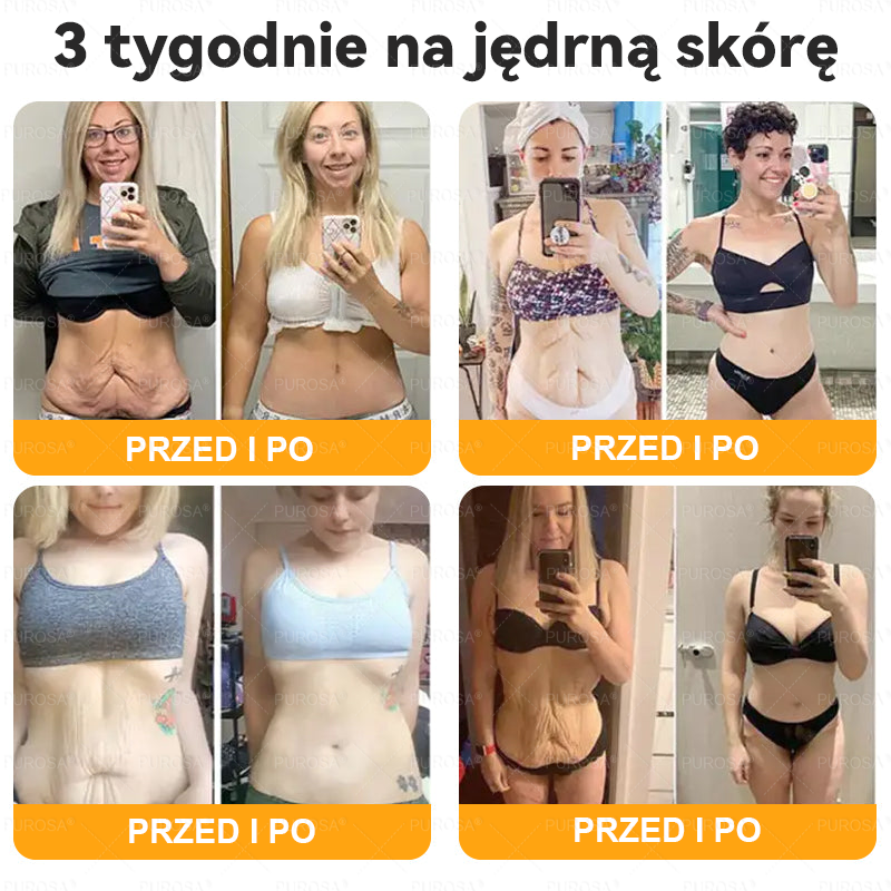 ⏰ Zostało już tylko 5 pudełek! Oferujemy Państwu dodatkowe 50% rabatu! Bądź fit i zdrowy. Jeśli przegrasz teraz, kolejną szansę dostaniesz dopiero w przyszłym roku.
