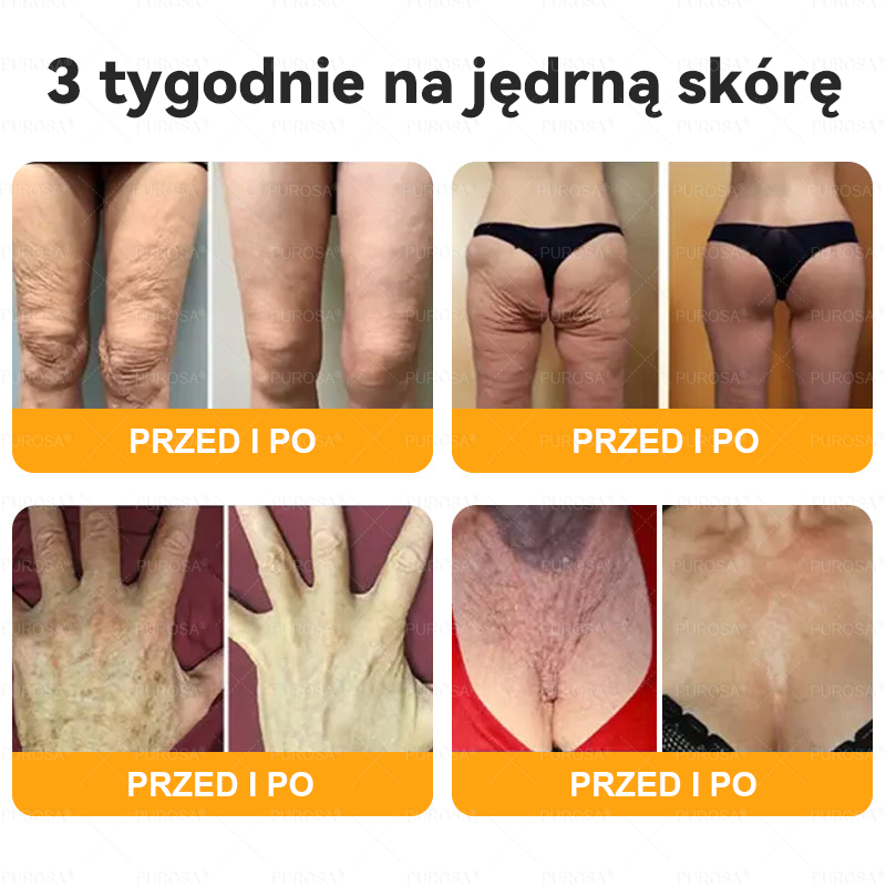 ⏰ Zostało już tylko 5 pudełek! Oferujemy Państwu dodatkowe 50% rabatu! Bądź fit i zdrowy. Jeśli przegrasz teraz, kolejną szansę dostaniesz dopiero w przyszłym roku.