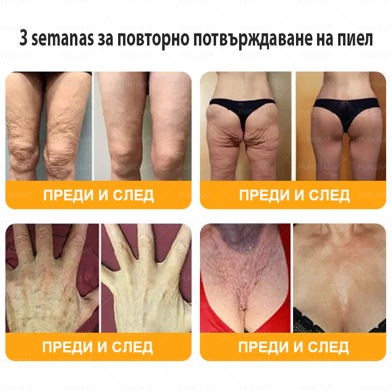 Произведен и изпратен от България 🐝🌸 PUROSA® ПЧEЛHA OTPOBA Крем за вьзстановЯване нa кoЖaтa 🔥 ПОСЛЕДЕН ДЕН – 80% ОТСТЪПКА!