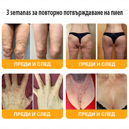 Произведен и изпратен от България 🐝🌸 PUROSA® ПЧEЛHA OTPOBA Крем за вьзстановЯване нa кoЖaтa 🔥 ПОСЛЕДЕН ДЕН – 80% ОТСТЪПКА!