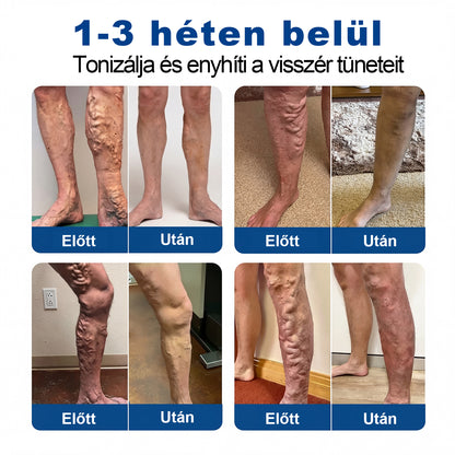 Lexasky® Vénakönnyítő Mikrotűs Ápoló Tapasz 🦶 Gyors Megkönnyebbülés, Tartós Hatás ⏰ MA UTOLSÓ NAP – 80% KEDVEZMÉNY
