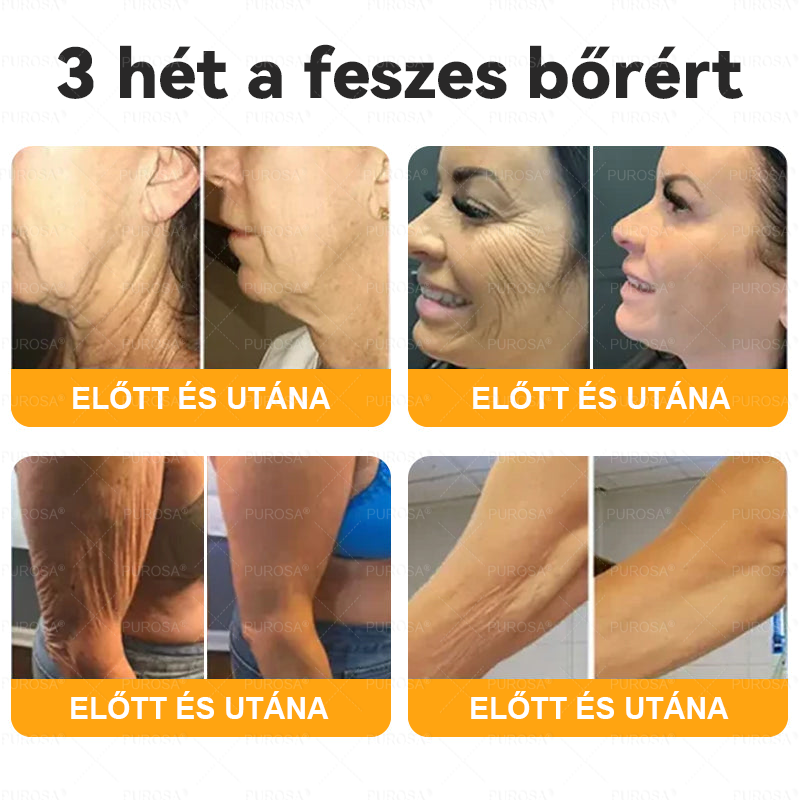 Magyarországról készült és szállított🐝🌸PUROSA® Méhméreg Bőrfelújító Krém 🔥 UTOLSÓ NAP – 80% KEDVEZMÉNY🔥