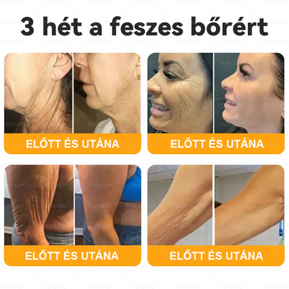Magyarországról készült és szállított🐝🌸PUROSA® Méhméreg Bőrfelújító Krém 🔥 UTOLSÓ NAP – 80% KEDVEZMÉNY🔥
