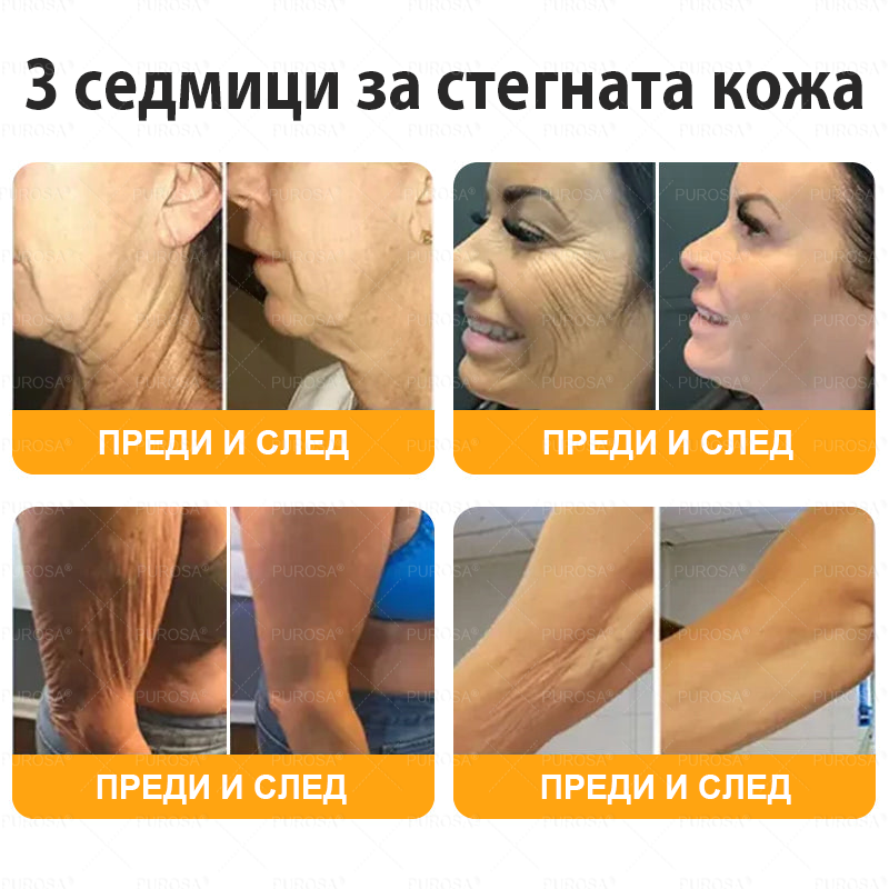 Произведен и изпратен от България 🐝🌸 PUROSA® ПЧEЛHA OTPOBA Крем за вьзстановЯване нa кoЖaтa 🔥 ПОСЛЕДЕН ДЕН – 80% ОТСТЪПКА!