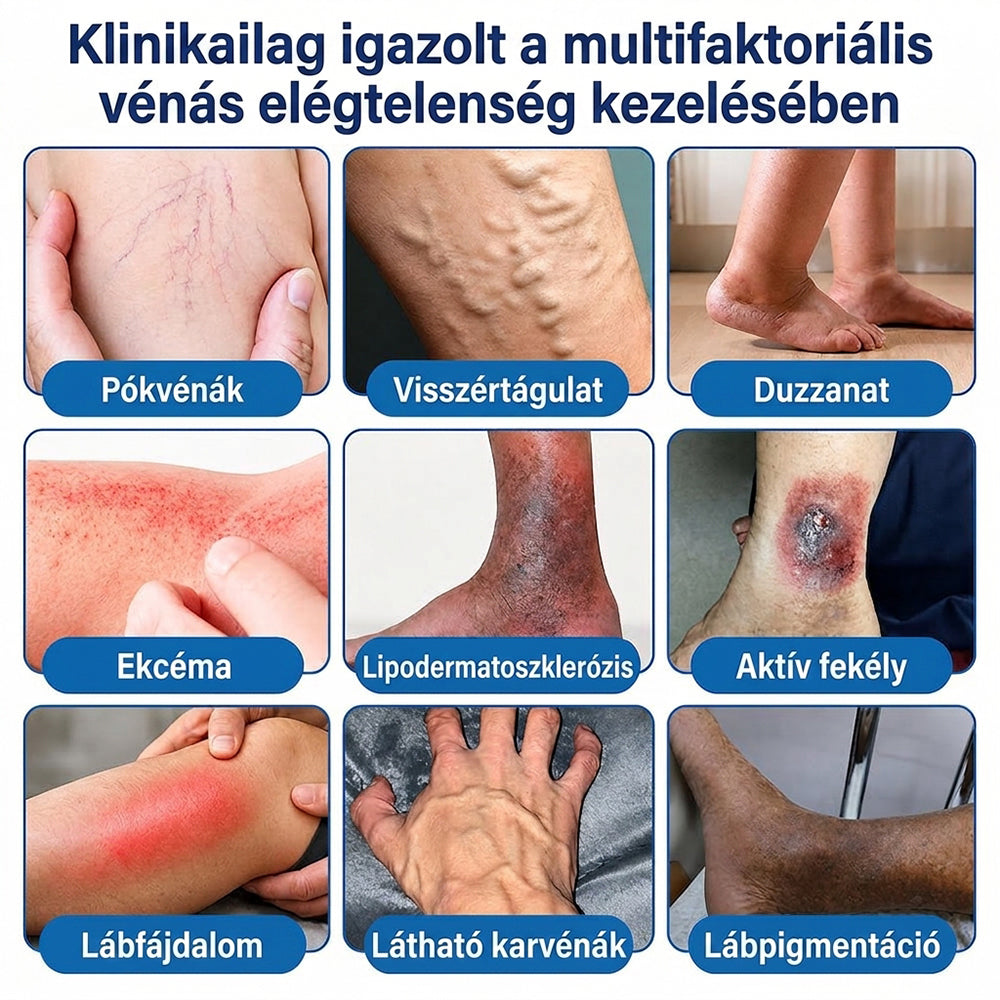 Lexasky® Vénakönnyítő Mikrotűs Ápoló Tapasz 🦶 Gyors Megkönnyebbülés, Tartós Hatás ⏰ MA UTOLSÓ NAP – 80% KEDVEZMÉNY