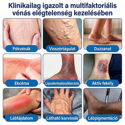 Lexasky® Vénakönnyítő Mikrotűs Ápoló Tapasz 🦶 Gyors Megkönnyebbülés, Tartós Hatás ⏰ MA UTOLSÓ NAP – 80% KEDVEZMÉNY