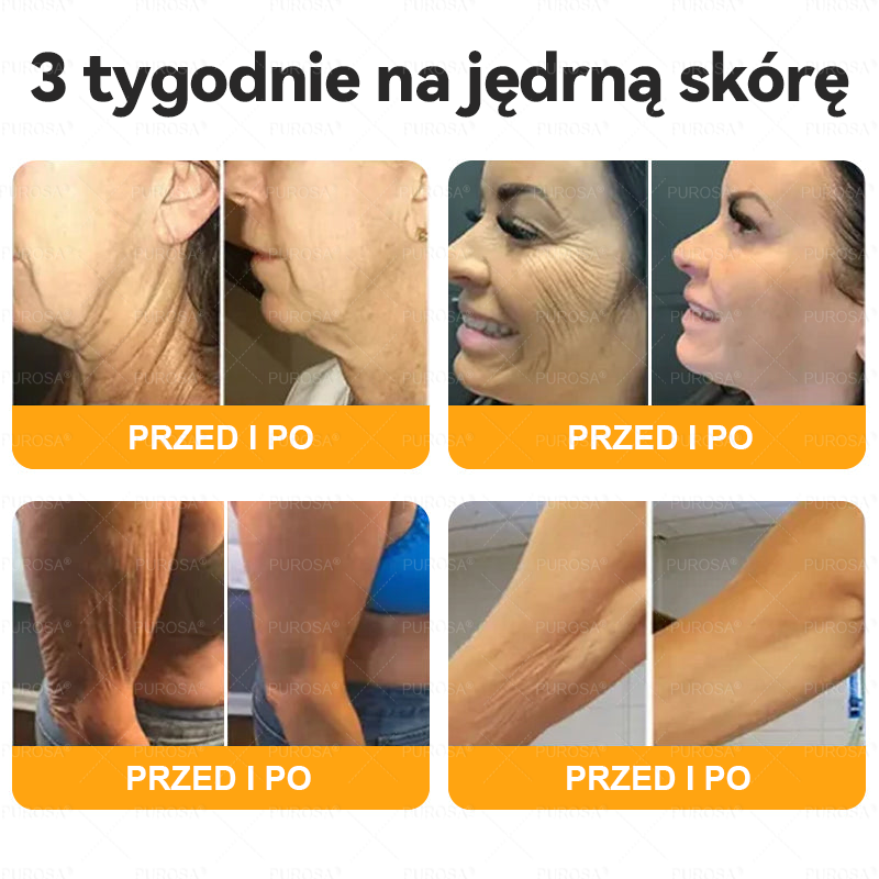 ⏰ Zostało już tylko 5 pudełek! Oferujemy Państwu dodatkowe 50% rabatu! Bądź fit i zdrowy. Jeśli przegrasz teraz, kolejną szansę dostaniesz dopiero w przyszłym roku.