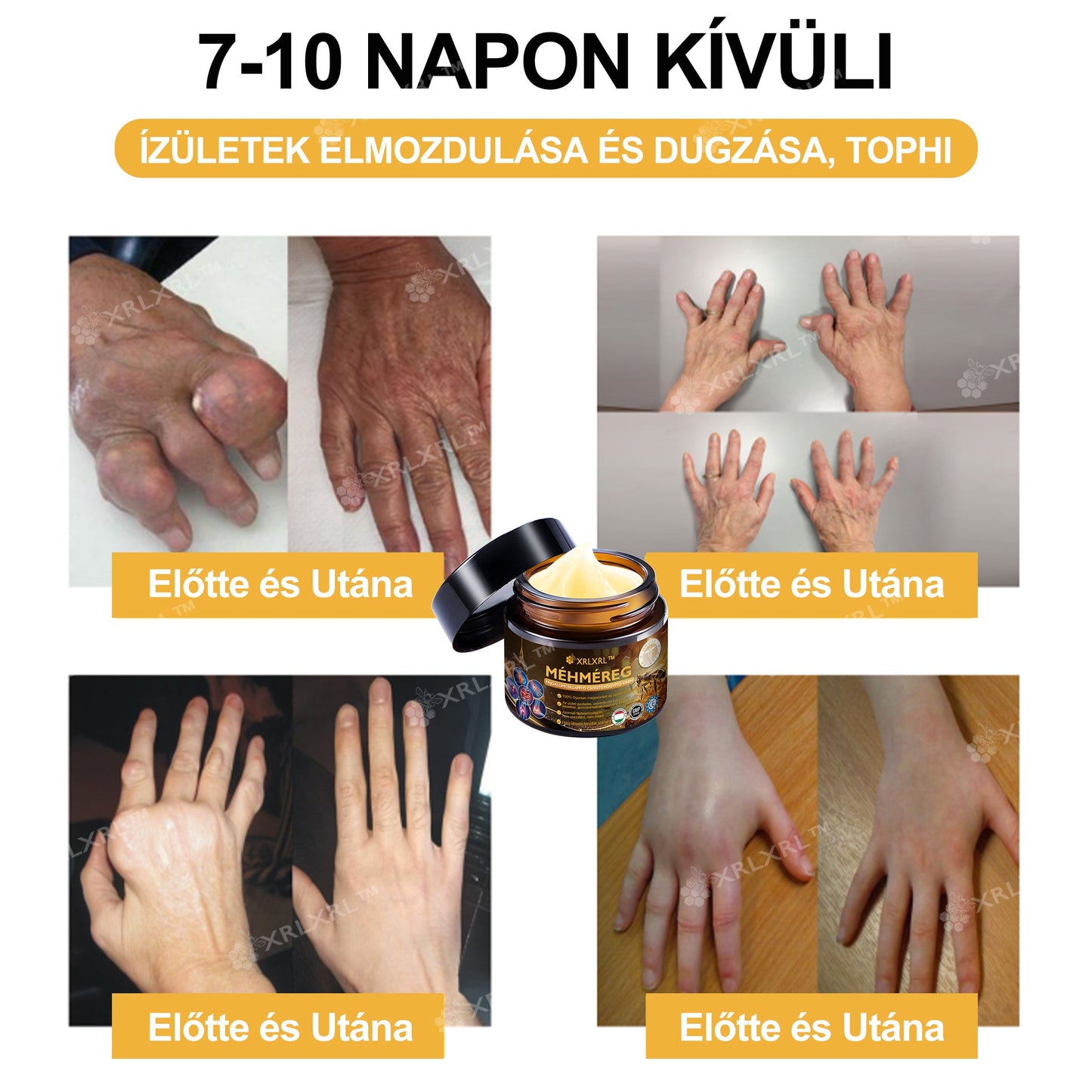 Hivatalos bolt: XRLXRL® Méhméreg Azonnali Ultra Erős Fájdalomcsillapító Krém - (Enyhíti a fájdalmat ízületi gyulladás, izomfájdalom, hátfájás, térdek, hát, vállak, csípők, csuklók, kezek esetén)