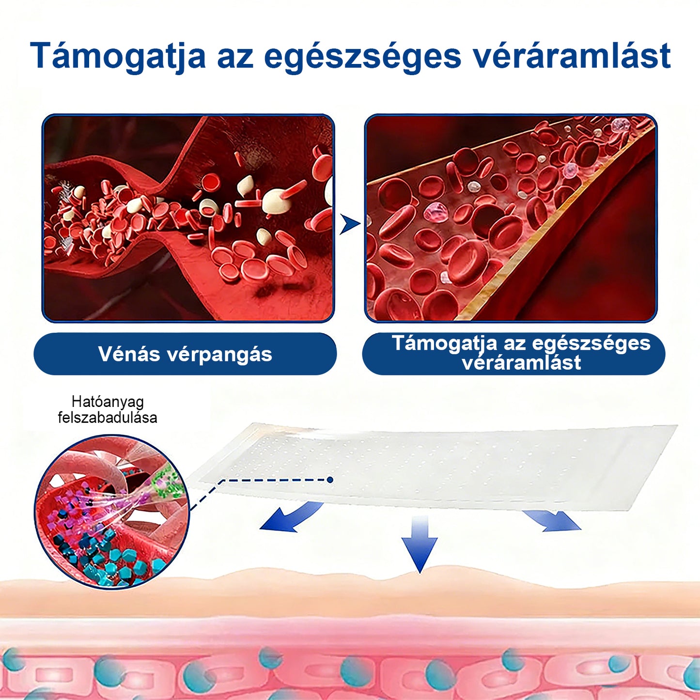 Lexasky® Vénakönnyítő Mikrotűs Ápoló Tapasz 🦶 Gyors Megkönnyebbülés, Tartós Hatás ⏰ MA UTOLSÓ NAP – 80% KEDVEZMÉNY