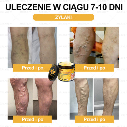 XRLXRL™ Krem Łagodzący Ból i Leczenie Kości z Jadłem Pszczelim (Specjalnie dla starszych dorosłych i polecany przez AAOS)