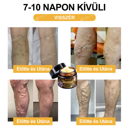 Hivatalos bolt: XRLXRL® Méhméreg Azonnali Ultra Erős Fájdalomcsillapító Krém - (Enyhíti a fájdalmat ízületi gyulladás, izomfájdalom, hátfájás, térdek, hát, vállak, csípők, csuklók, kezek esetén)