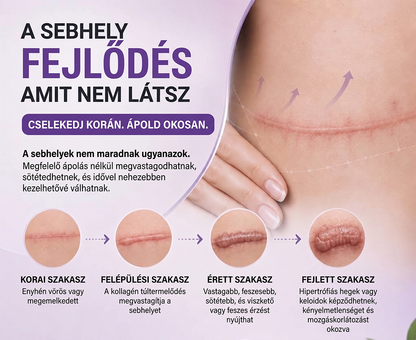 PUROSA®🩹 Orvosi tisztaságú szilikon hegápoló görgő (Kiemelkedő, piros, kemény, feszülő és elszíneződött műtéti hegekre)
