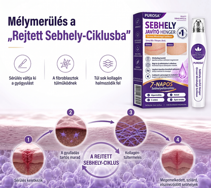 PUROSA®🩹 Orvosi tisztaságú szilikon hegápoló görgő (Kiemelkedő, piros, kemény, feszülő és elszíneződött műtéti hegekre)