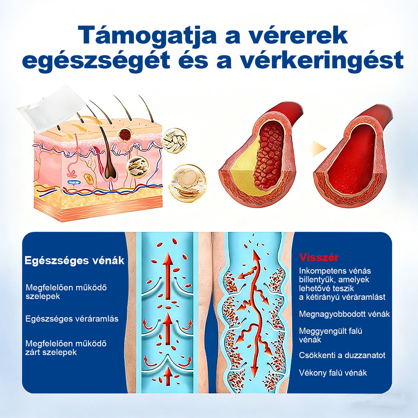 Lexasky® Vénakönnyítő Mikrotűs Ápoló Tapasz 🦶 Gyors Megkönnyebbülés, Tartós Hatás ⏰ MA UTOLSÓ NAP – 80% KEDVEZMÉNY