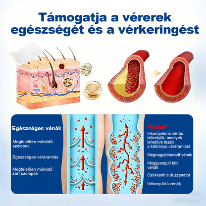 Lexasky® Vénakönnyítő Mikrotűs Ápoló Tapasz 🦶 Gyors Megkönnyebbülés, Tartós Hatás ⏰ MA UTOLSÓ NAP – 80% KEDVEZMÉNY