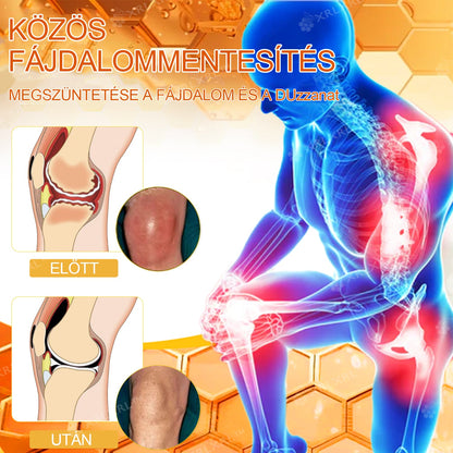 Hivatalos bolt: XRLXRL® Méhméreg Azonnali Ultra Erős Fájdalomcsillapító Krém - (Enyhíti a fájdalmat ízületi gyulladás, izomfájdalom, hátfájás, térdek, hát, vállak, csípők, csuklók, kezek esetén)