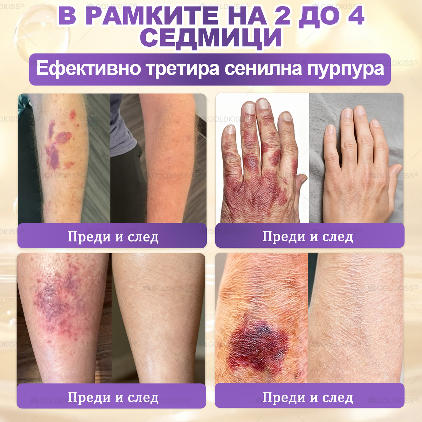 ⏰Остават само 5 кутии! Предлагаме допълнителна отстъпка от 50%! Бъдете във форма и здрави. Ако загубите сега, ще имате шанс само догодина.