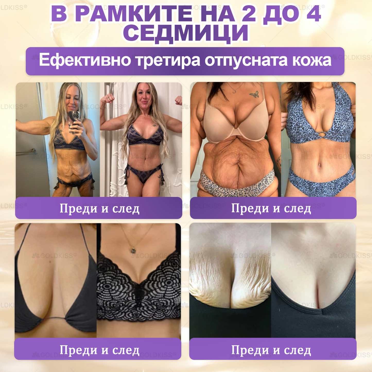 ⏰Остават само 5 кутии! Предлагаме допълнителна отстъпка от 50%! Бъдете във форма и здрави. Ако загубите сега, ще имате шанс само догодина.