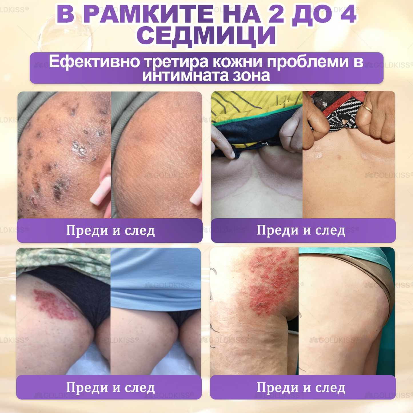 ⏰Остават само 5 кутии! Предлагаме допълнителна отстъпка от 50%! Бъдете във форма и здрави. Ако загубите сега, ще имате шанс само догодина.