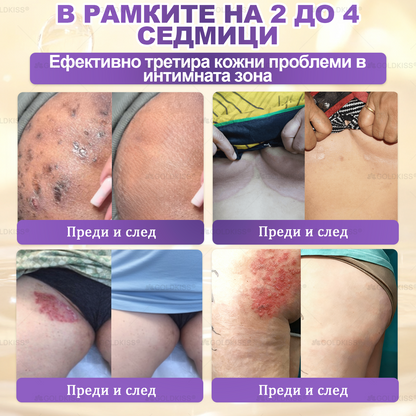 ⏰Остават само 5 кутии! Предлагаме допълнителна отстъпка от 50%! Бъдете във форма и здрави. Ако загубите сега, ще имате шанс само догодина.