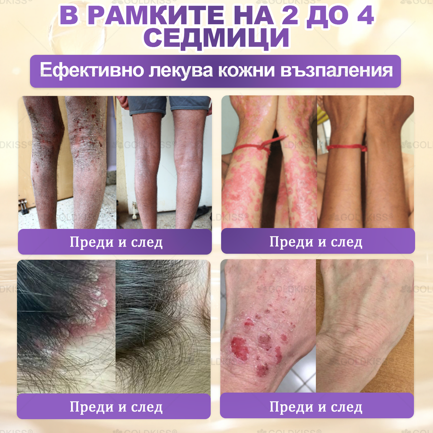 ⏰Остават само 5 кутии! Предлагаме допълнителна отстъпка от 50%! Бъдете във форма и здрави. Ако загубите сега, ще имате шанс само догодина.