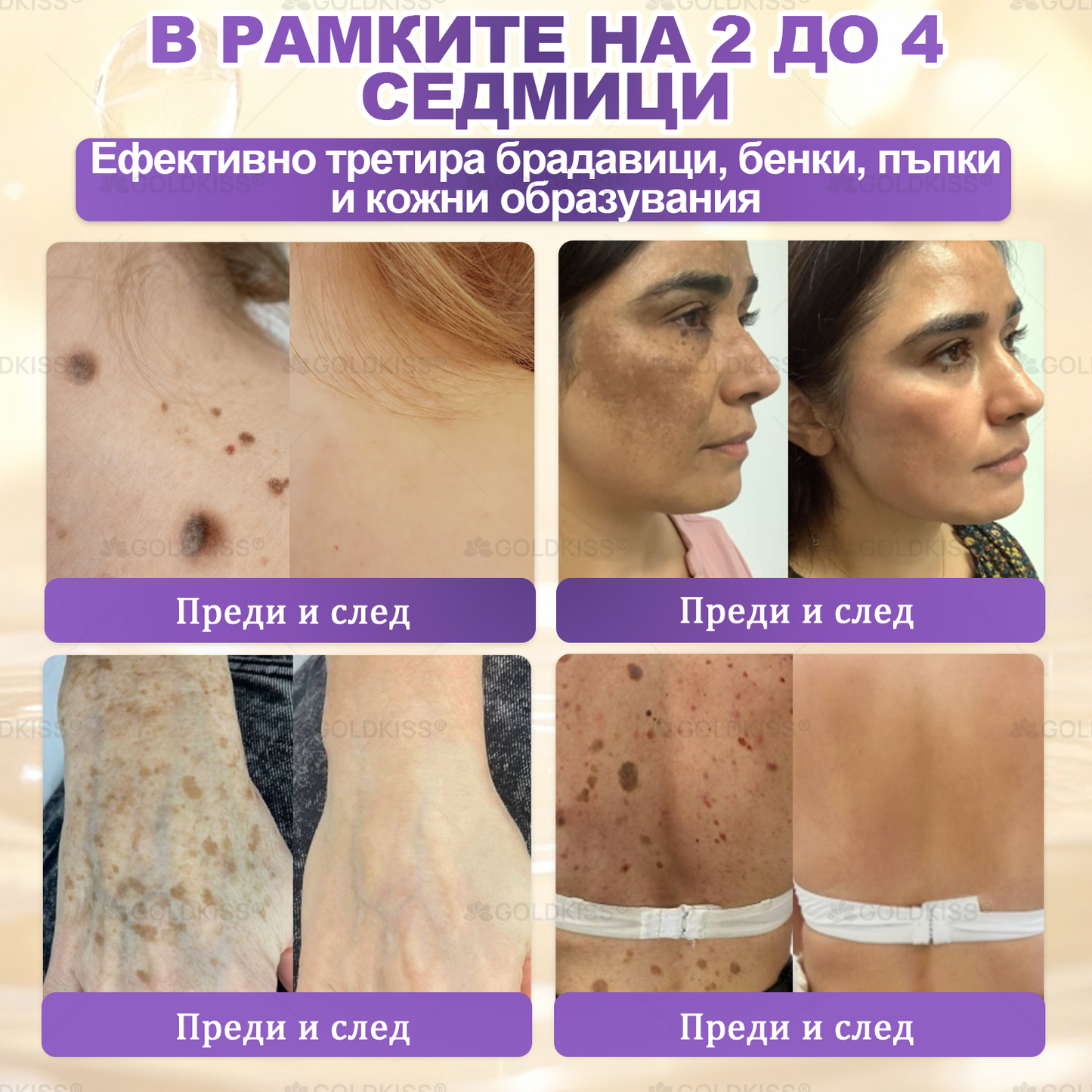 ⏰Остават само 5 кутии! Предлагаме допълнителна отстъпка от 50%! Бъдете във форма и здрави. Ако загубите сега, ще имате шанс само догодина.