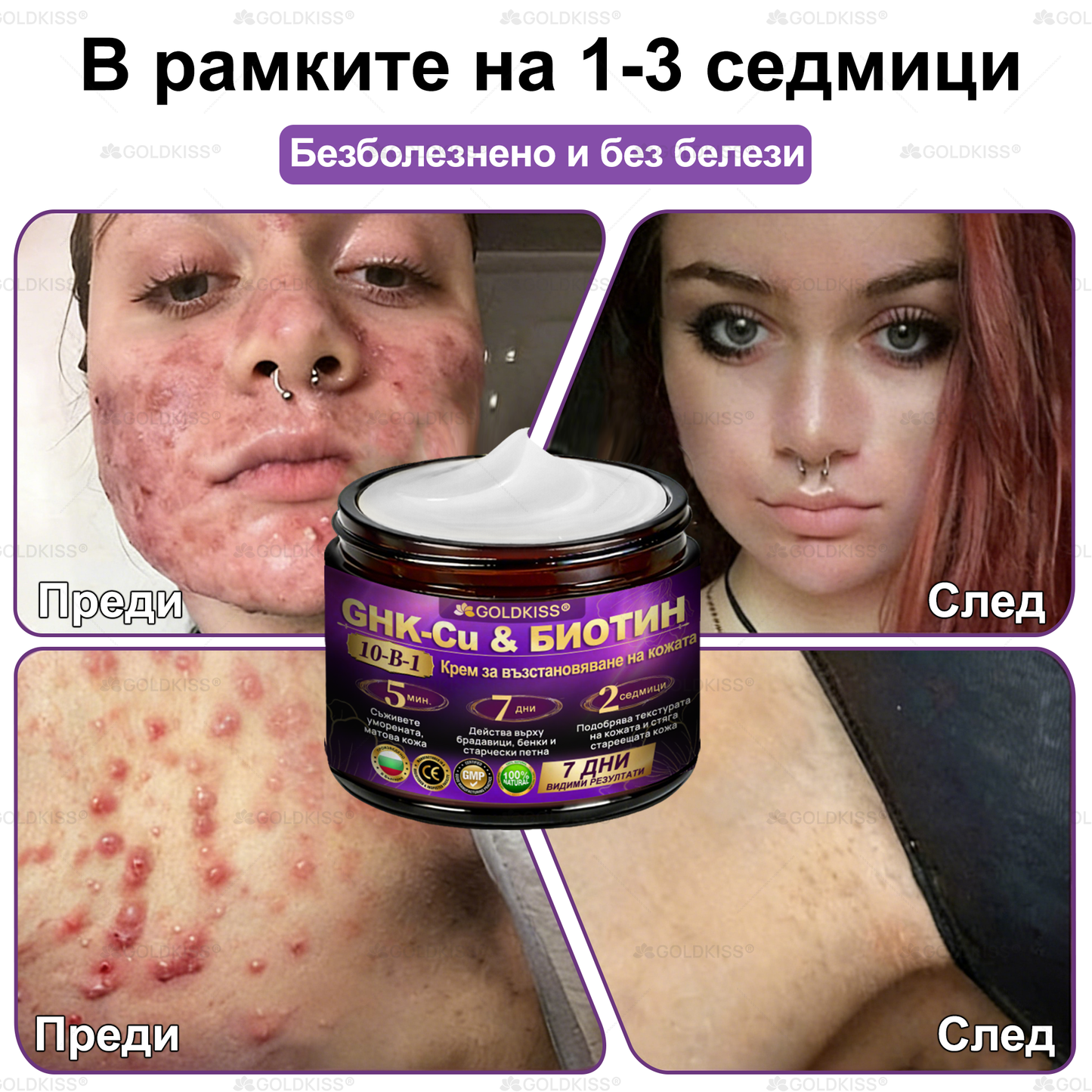 ⏰Остават само 5 кутии! Предлагаме допълнителна отстъпка от 50%! Бъдете във форма и здрави. Ако загубите сега, ще имате шанс само догодина.