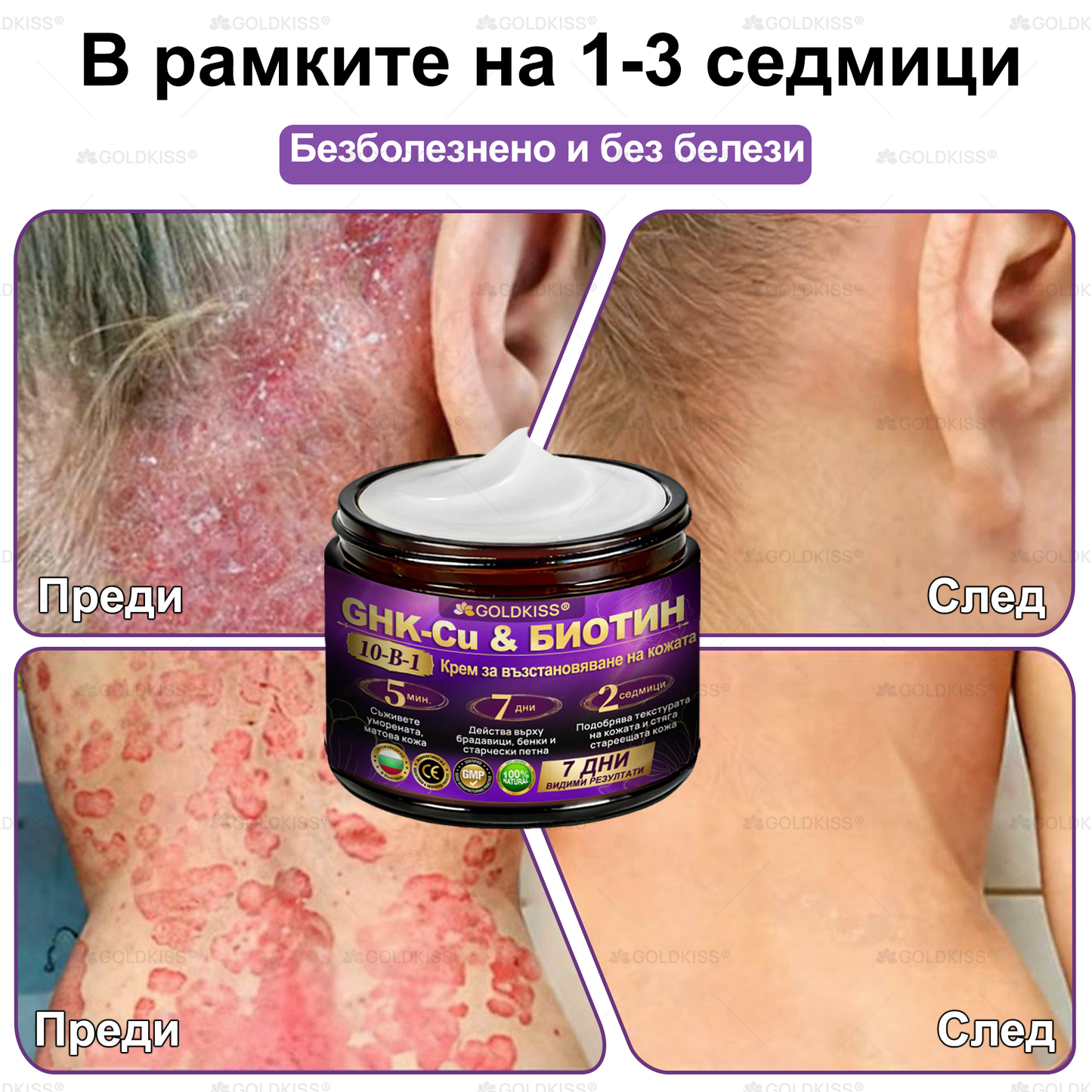 ⏰Остават само 5 кутии! Предлагаме допълнителна отстъпка от 50%! Бъдете във форма и здрави. Ако загубите сега, ще имате шанс само догодина.