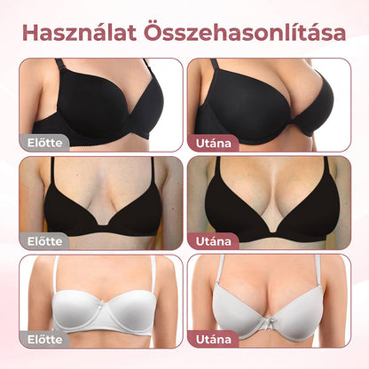 HISKIN®🌟 MELLEMELŐ ÉS FESZESÍTŐ MIKROTŰS TAPASZOK