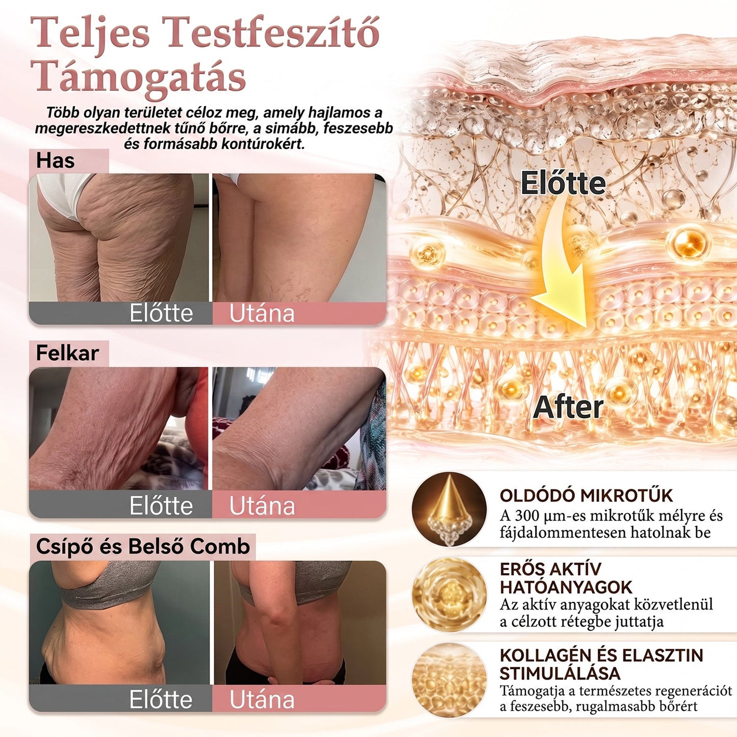 HISKIN®🌟 MELLEMELŐ ÉS FESZESÍTŐ MIKROTŰS TAPASZOK