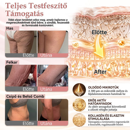 HISKIN®🌟 MELLEMELŐ ÉS FESZESÍTŐ MIKROTŰS TAPASZOK