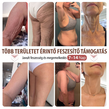 HISKIN®🌟 MELLEMELŐ ÉS FESZESÍTŐ MIKROTŰS TAPASZOK